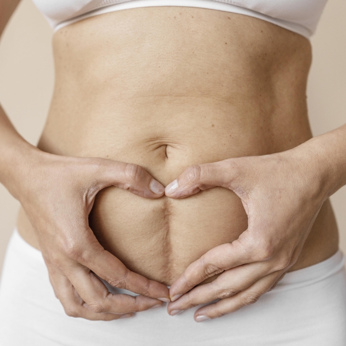 Corectia cicatricilor